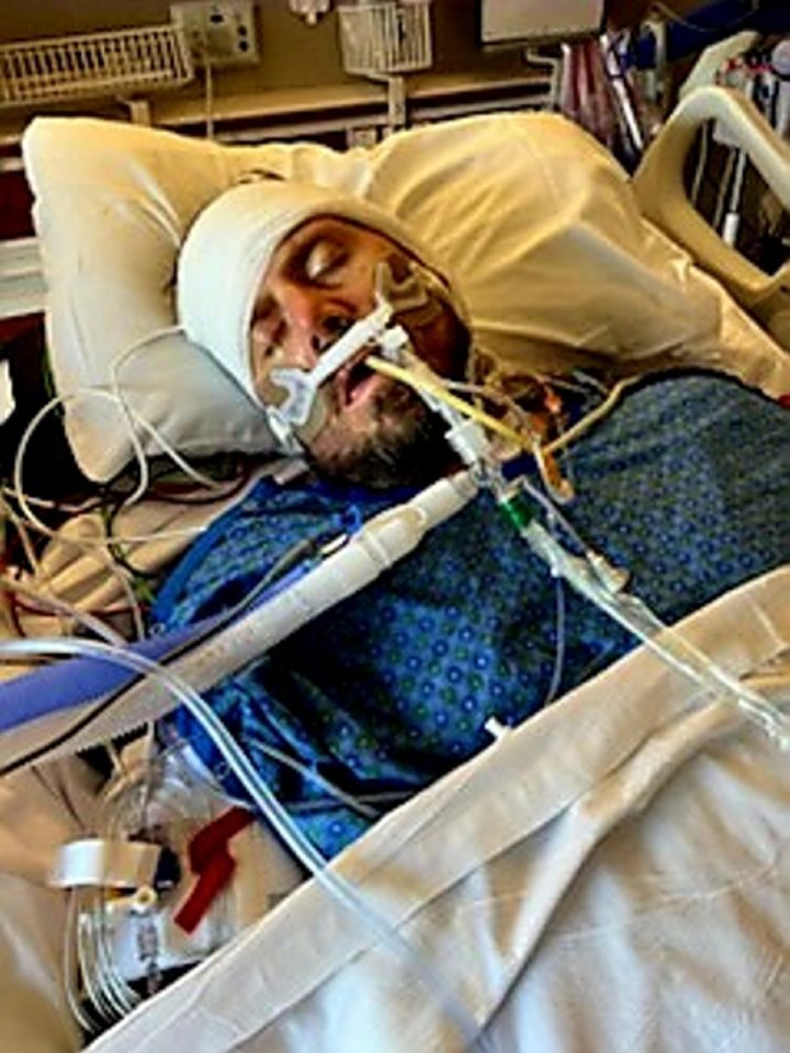 Man in hospital bed with medical tubes.