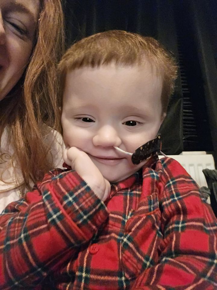 Close-up photo of a toddler in a red plaid shirt with a nasal cannula.