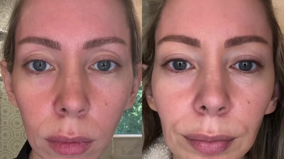 Before and after photos comparing skincare products.