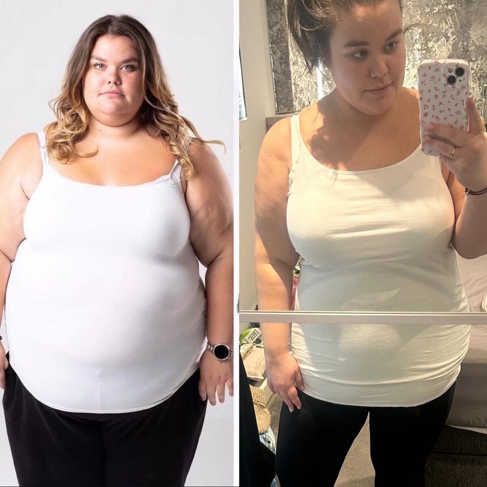 Before and after photos of Amy Tapper's weight loss.