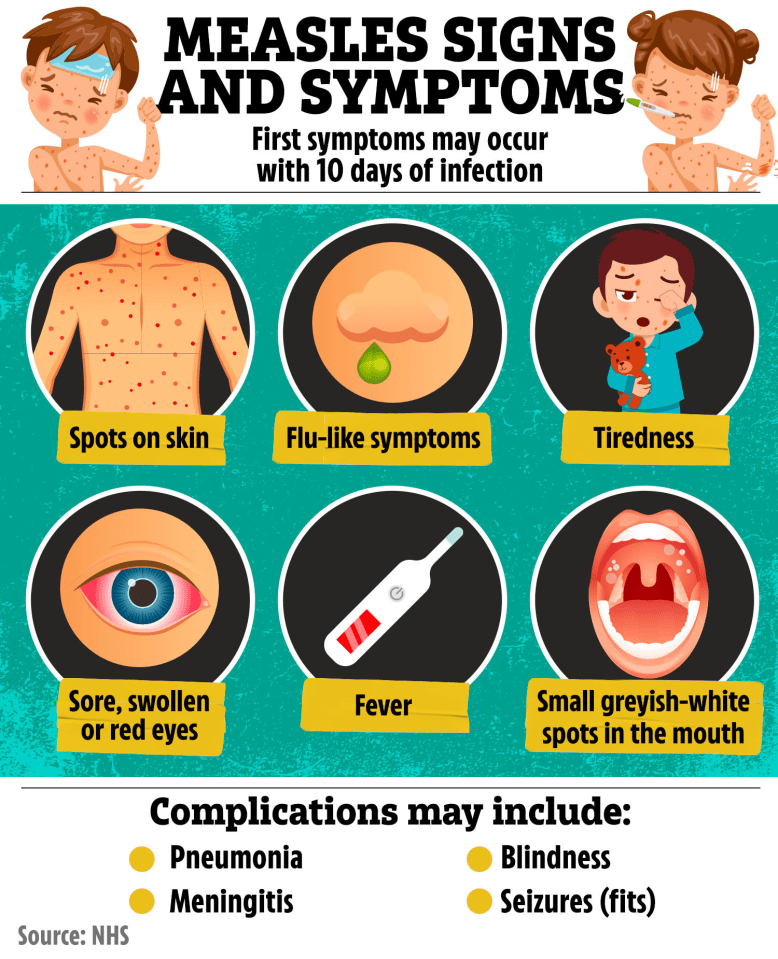 Measles can cause a range of symptoms, including white spots in the mouth and a spotty rash