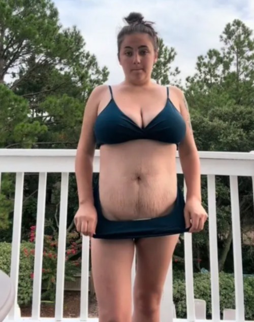 Jayde showed off her stretch marks after giving birth