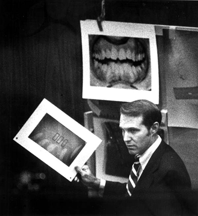 Photos of Bundy's teeth were shown at his trial