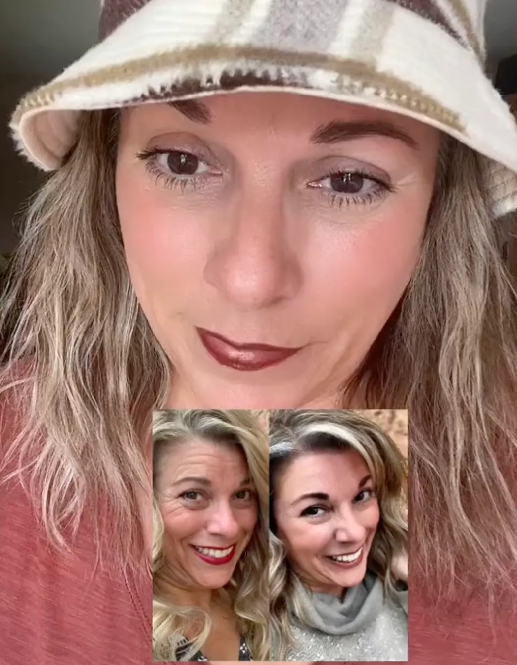 Sonja shared photos of how her skin looked before she researched anti-aging products