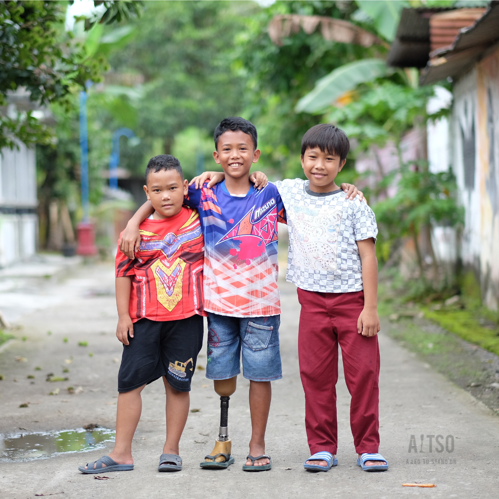 Three children standing with their arms around each other's shoulders. The child in the middle has a prosthetic leg.