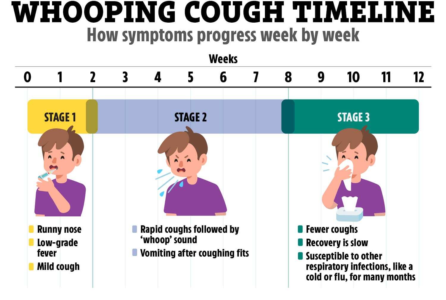 Timeline reveals the symptoms of the '100-day cough' week-by-week