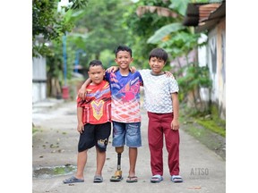 Three children standing with their arms around each other's shoulders. The child in the middle has a prosthetic leg.- @ALTSO