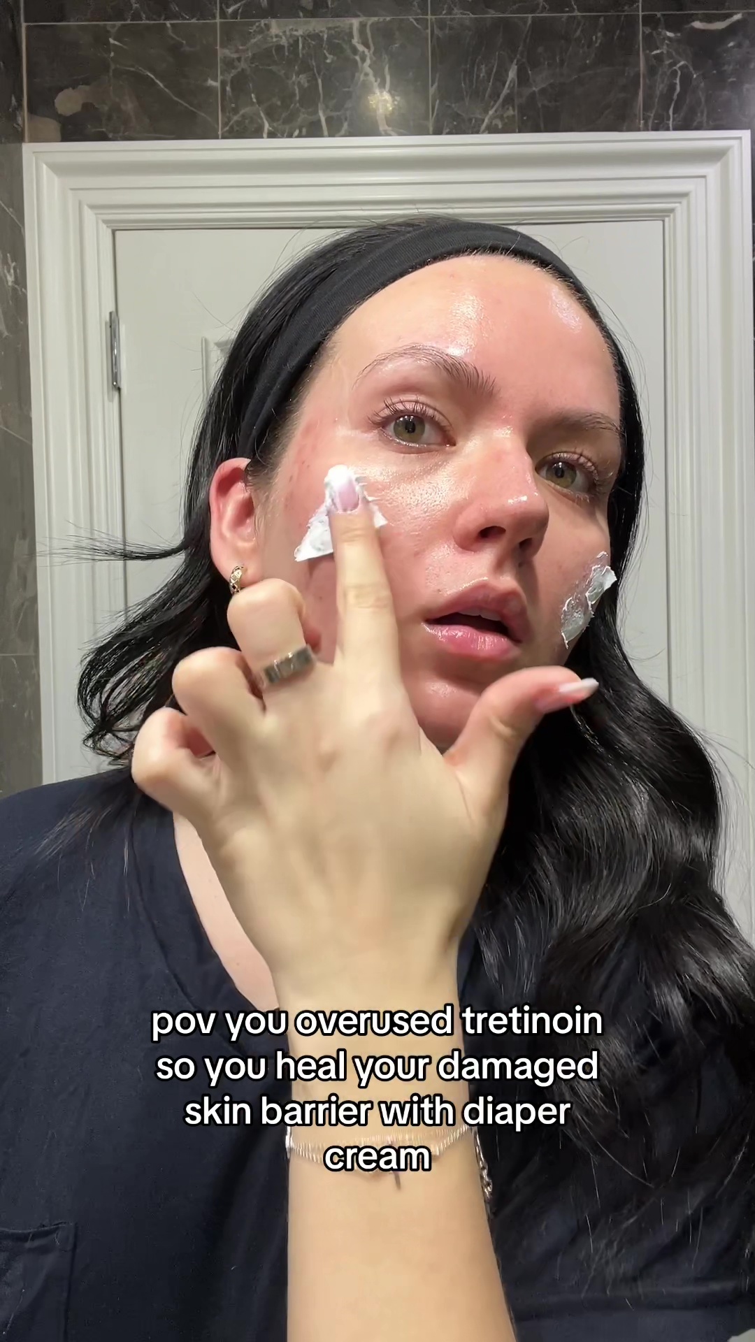 The cheap hack helped Viktoria's skin after she damaged it