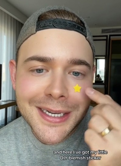 Jake-Jamie shared how he DIYed his own acne patches