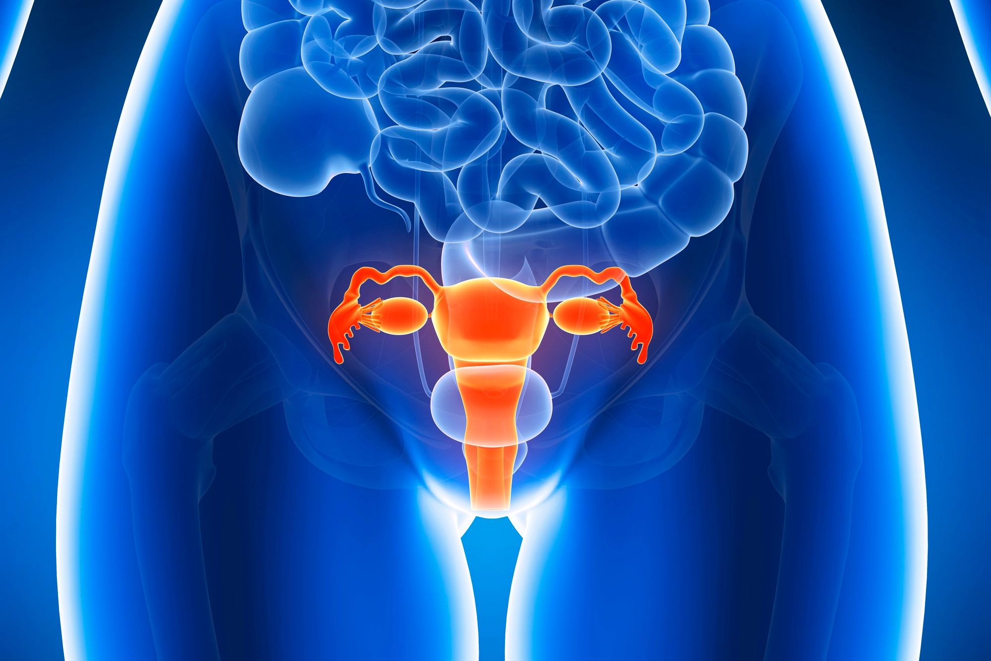 Cervical cancer is a cancer that's found anywhere in the cervix, which is the opening between the vagina and womb