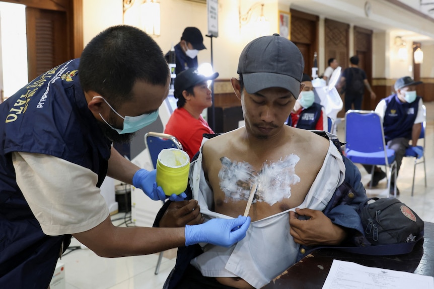 A person uses a small sptick to apply a numbing cream to a man's chest before his tattoo is removed with a laser.