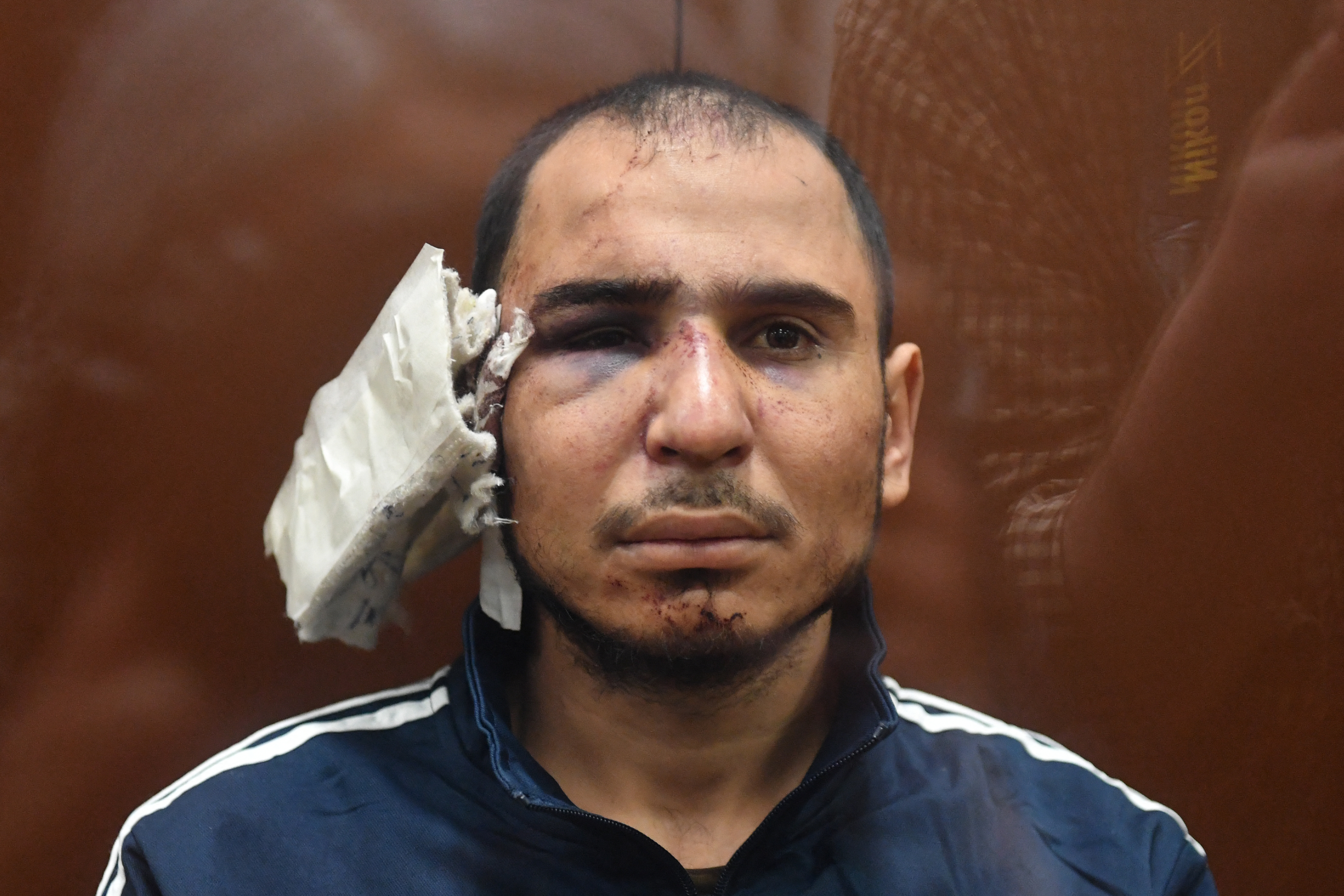 Saidakrami Murodali Rachabalizoda had a bandage where his right ear should be