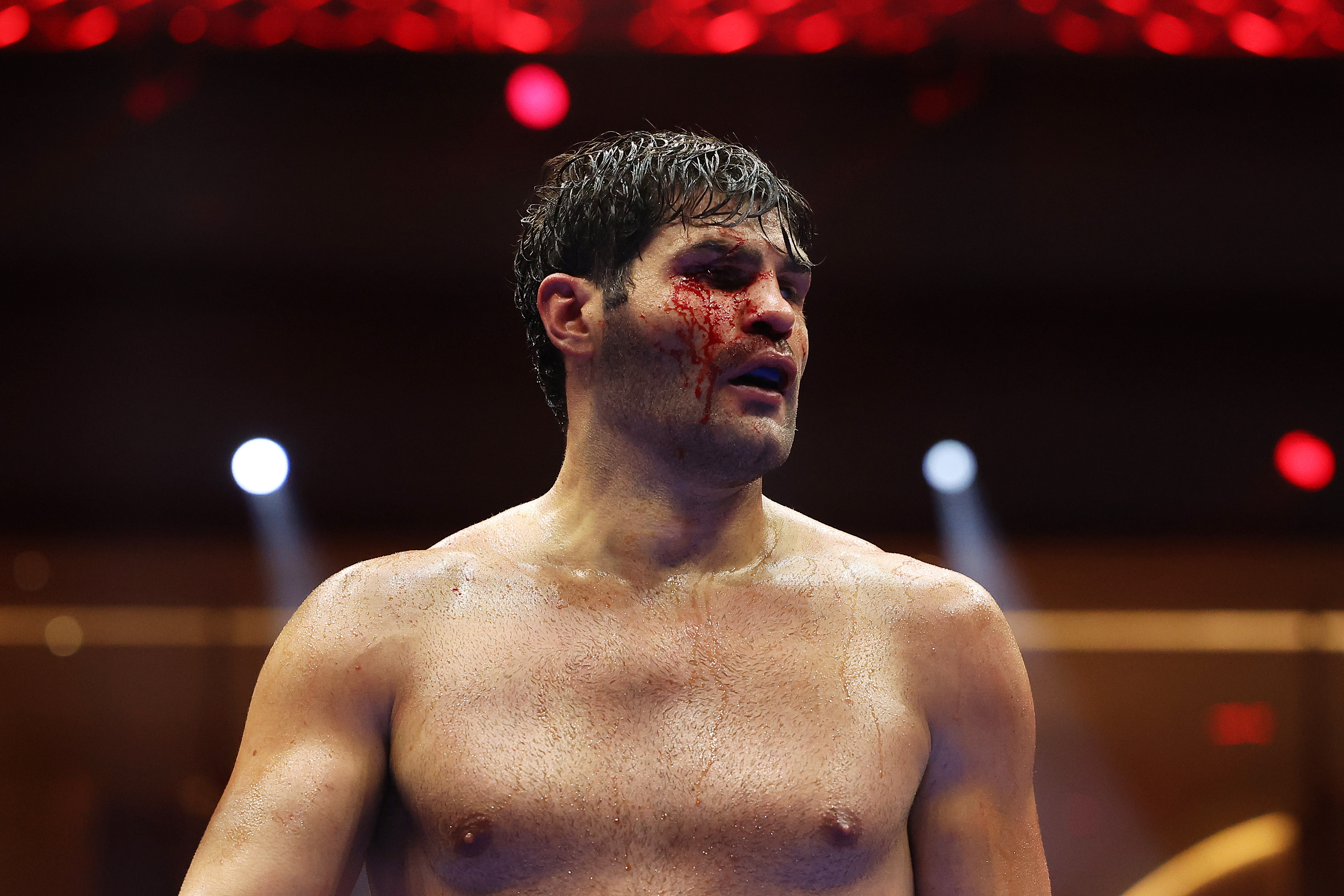 Hrgovic was left bloodied and bruised