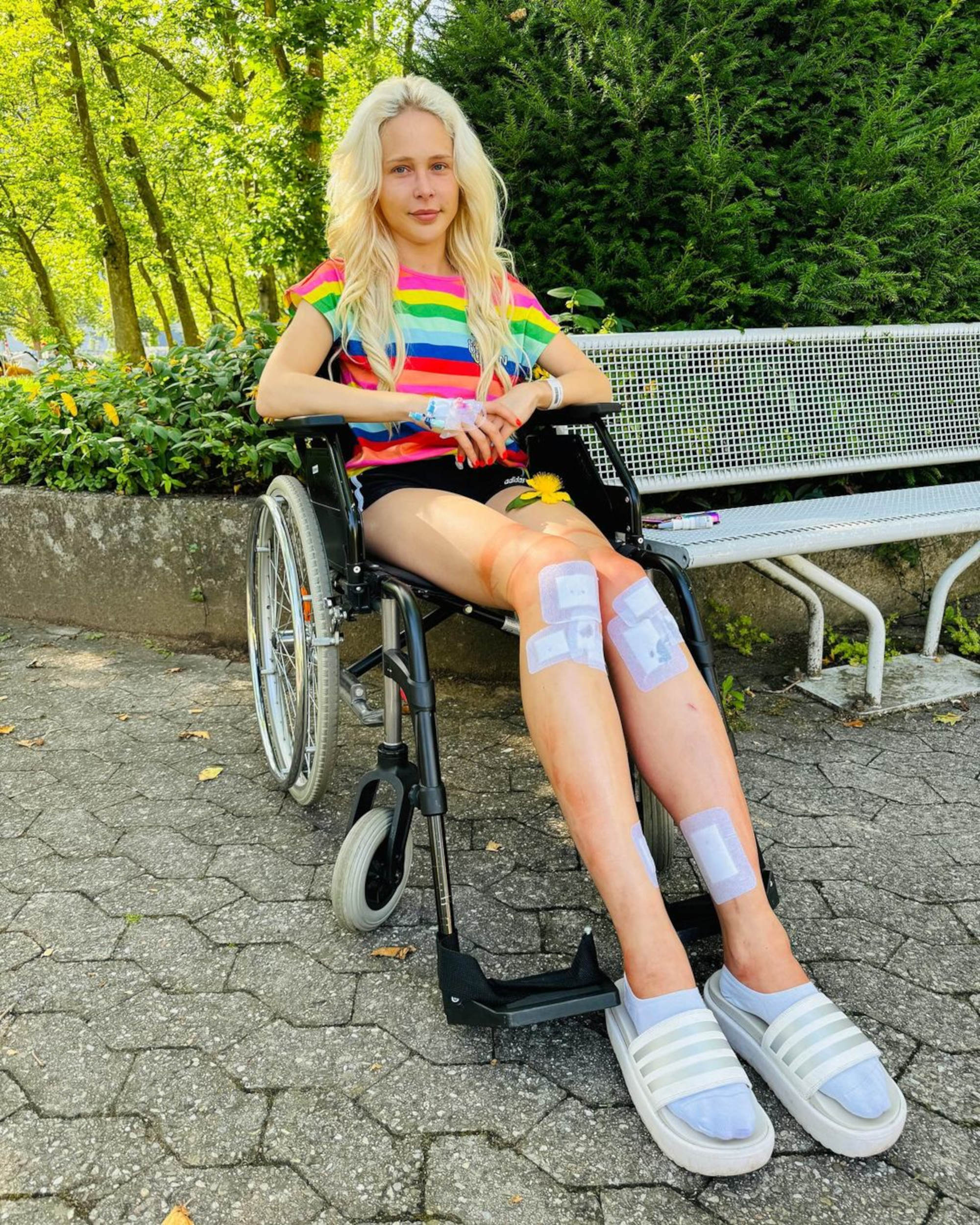 Theresia Fischer leaving the hospital after having her adjustable rods removed