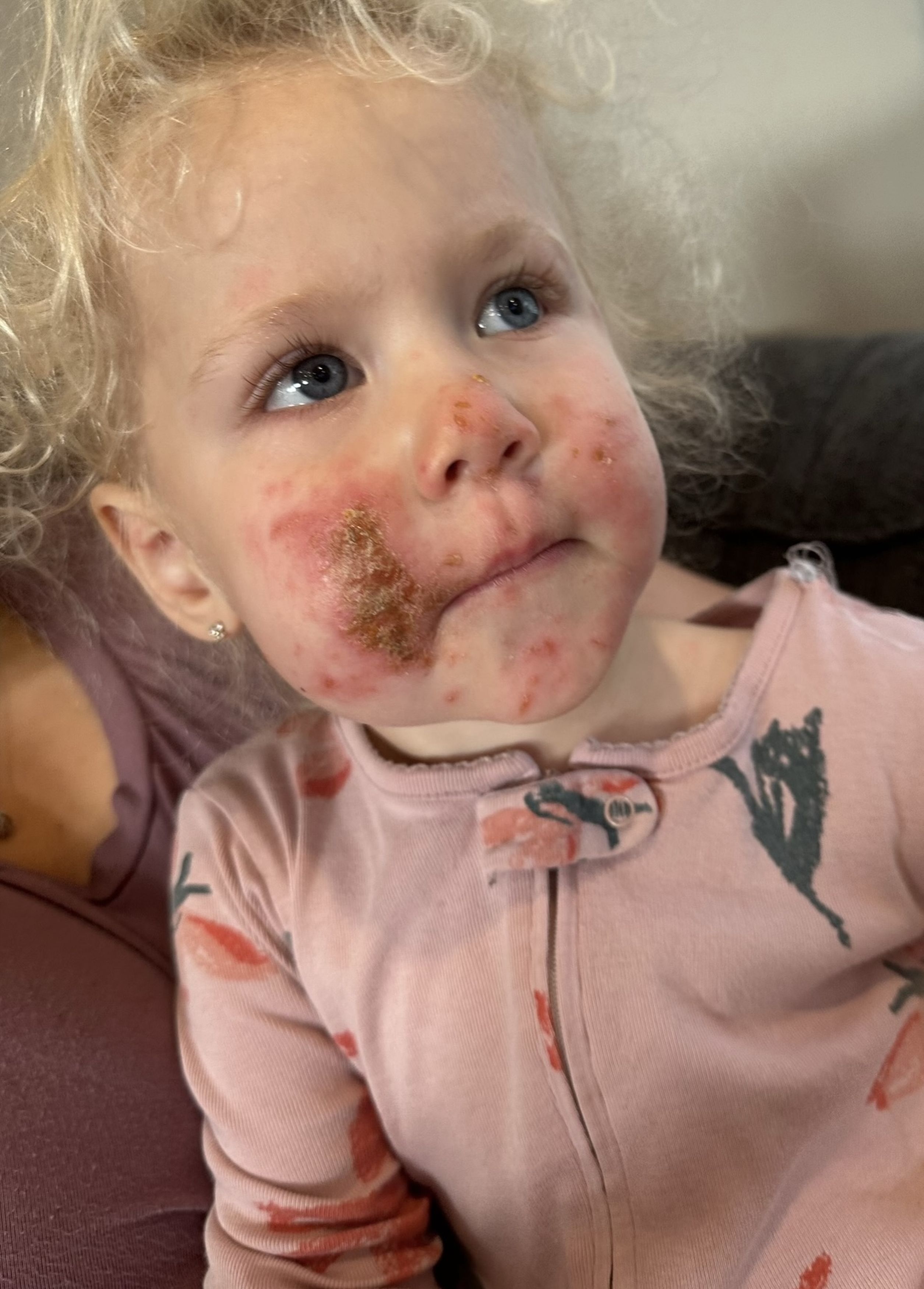 Ella had been playing in the garden when she came into contact with the dangerous flower (Credit: Kennedy News and Media)