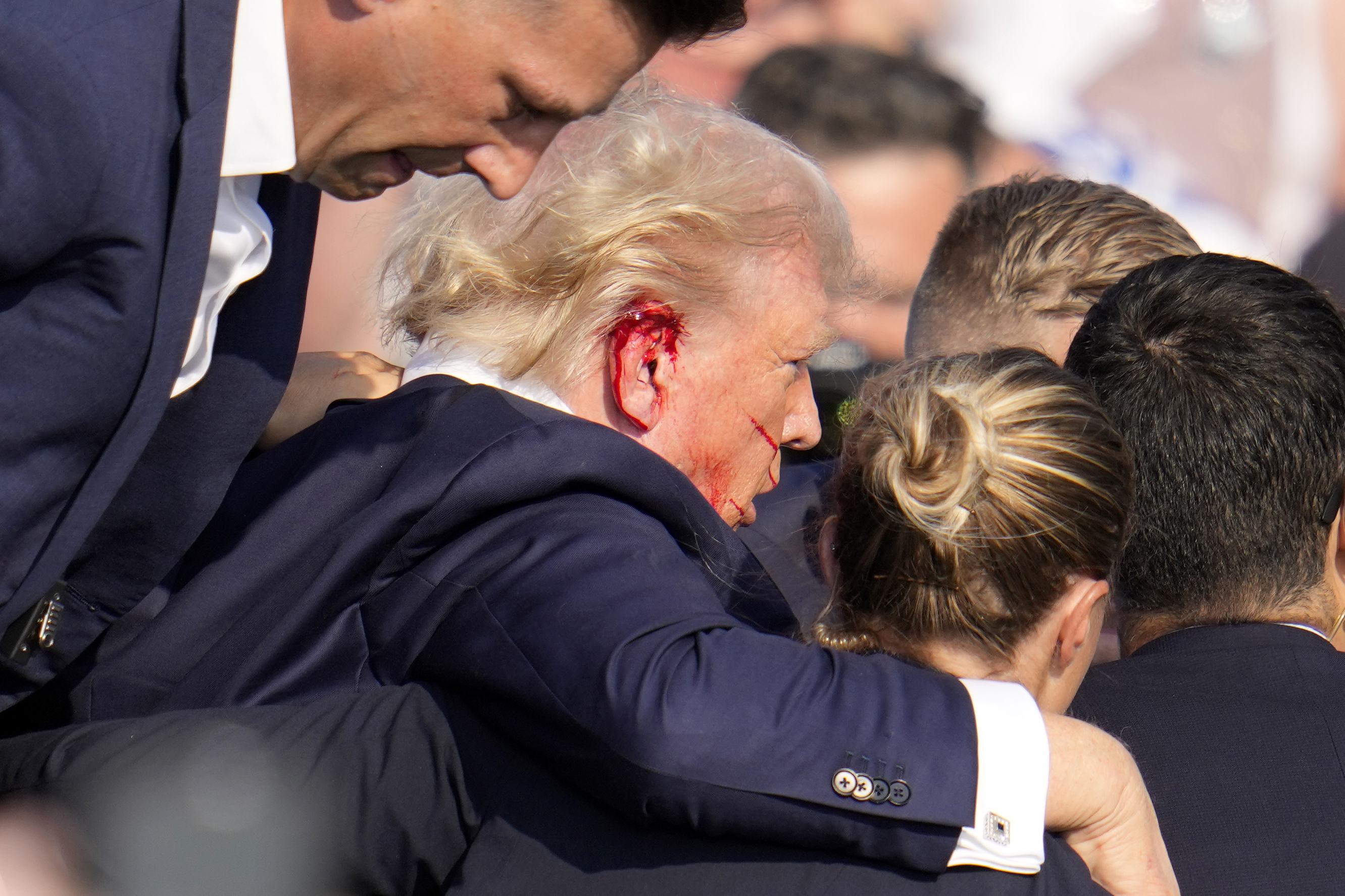 Trump was seen bleeding from his right ear as Secret Service agents whisked him away and mounted him into a motorcade