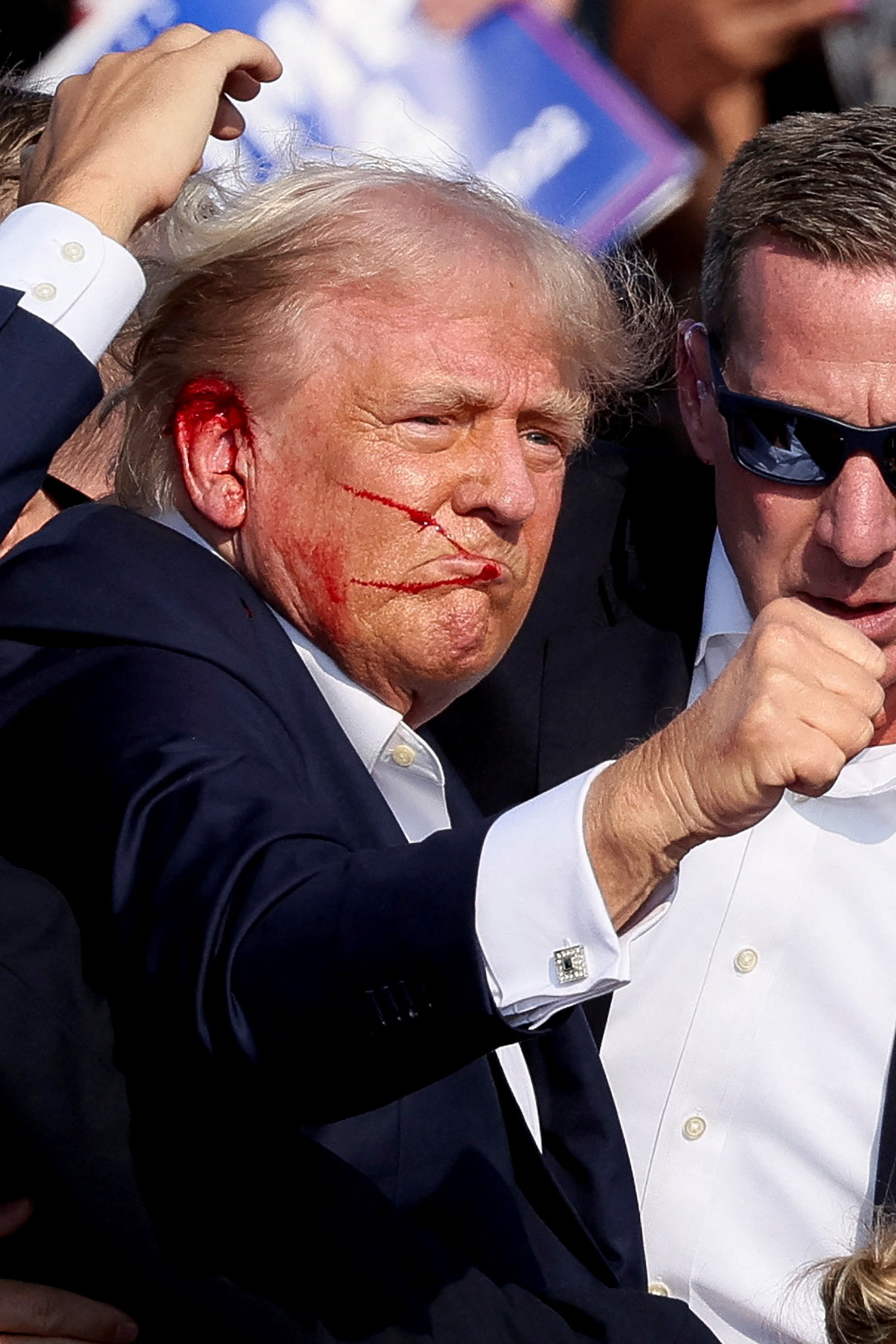 Trump sustained a wound to his right ear