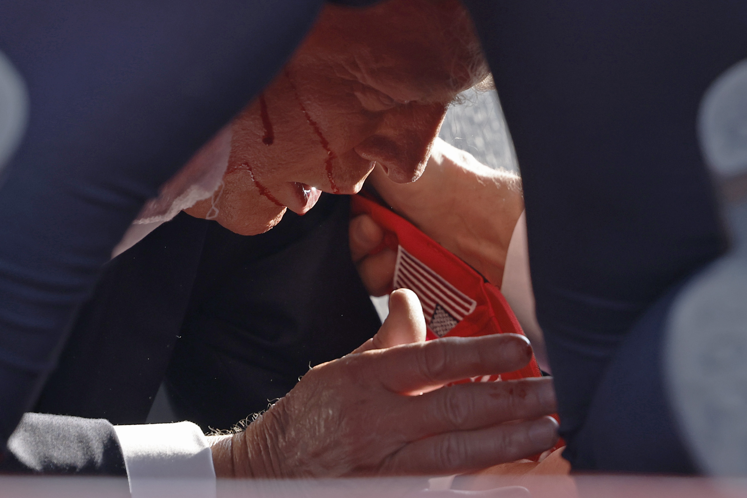 Trump suffered a 2-centimeter graze wound to his right ear