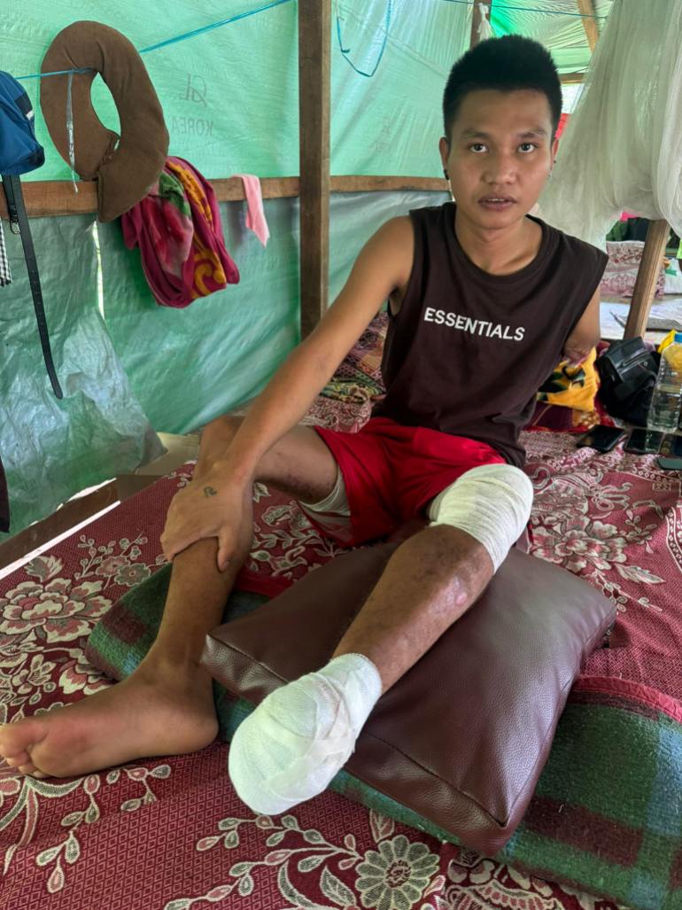 Aung Nge sitting on a floor cushion in a shelter. He has large bandages around his left foot and knee. 