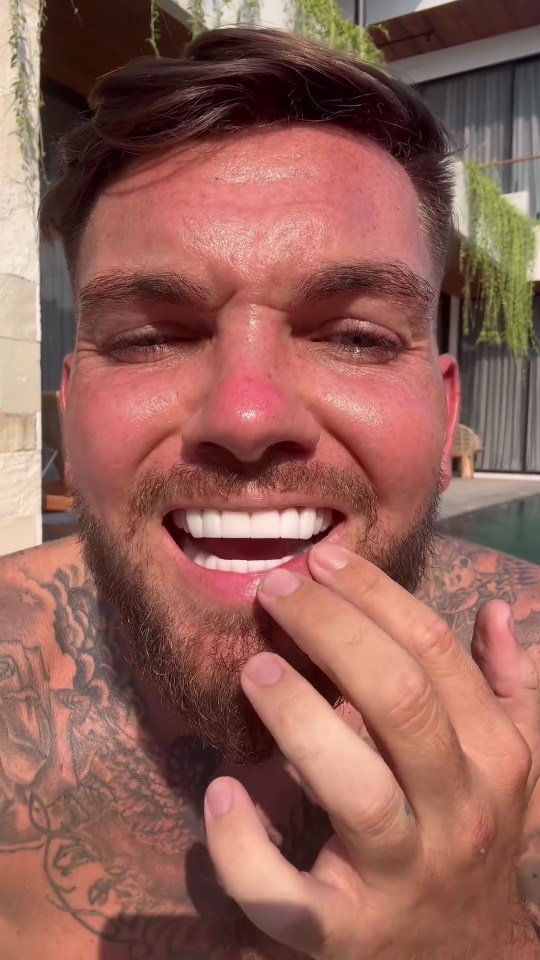 The Geordie Shore star showed off his veneers