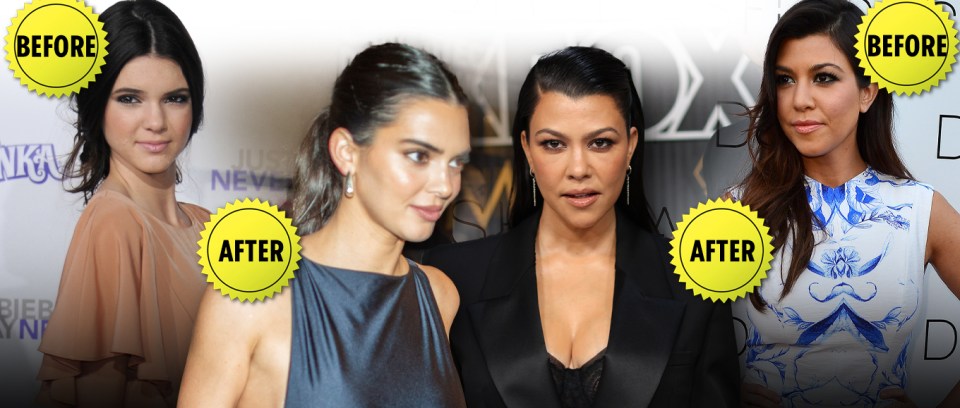 Dr. Harper of Juvly Aesthetics speculated facial work on Kourtney Kardashian Barker and Kendall Jenner