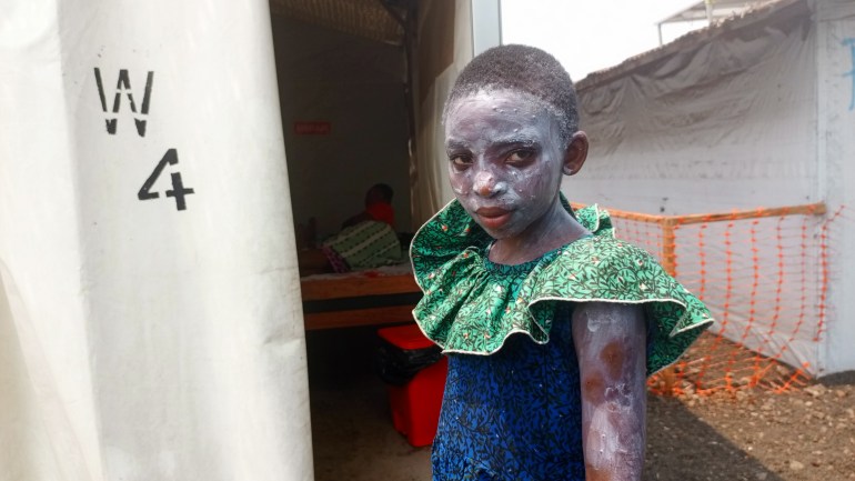 An mpox patient 