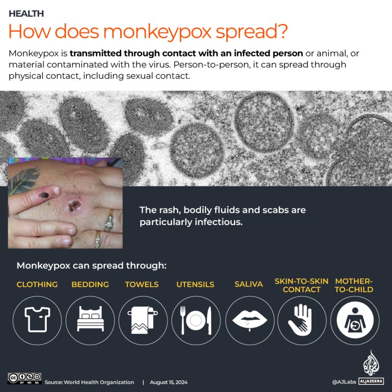 INTERACTIVE- How does monkeypox spread infographic-1723724440