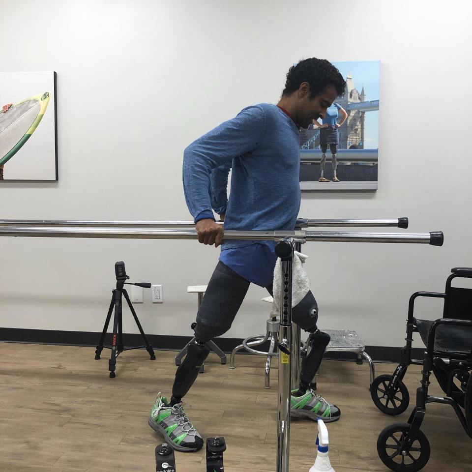 Obi Ndefo working out on a bar with his prosthetic legs