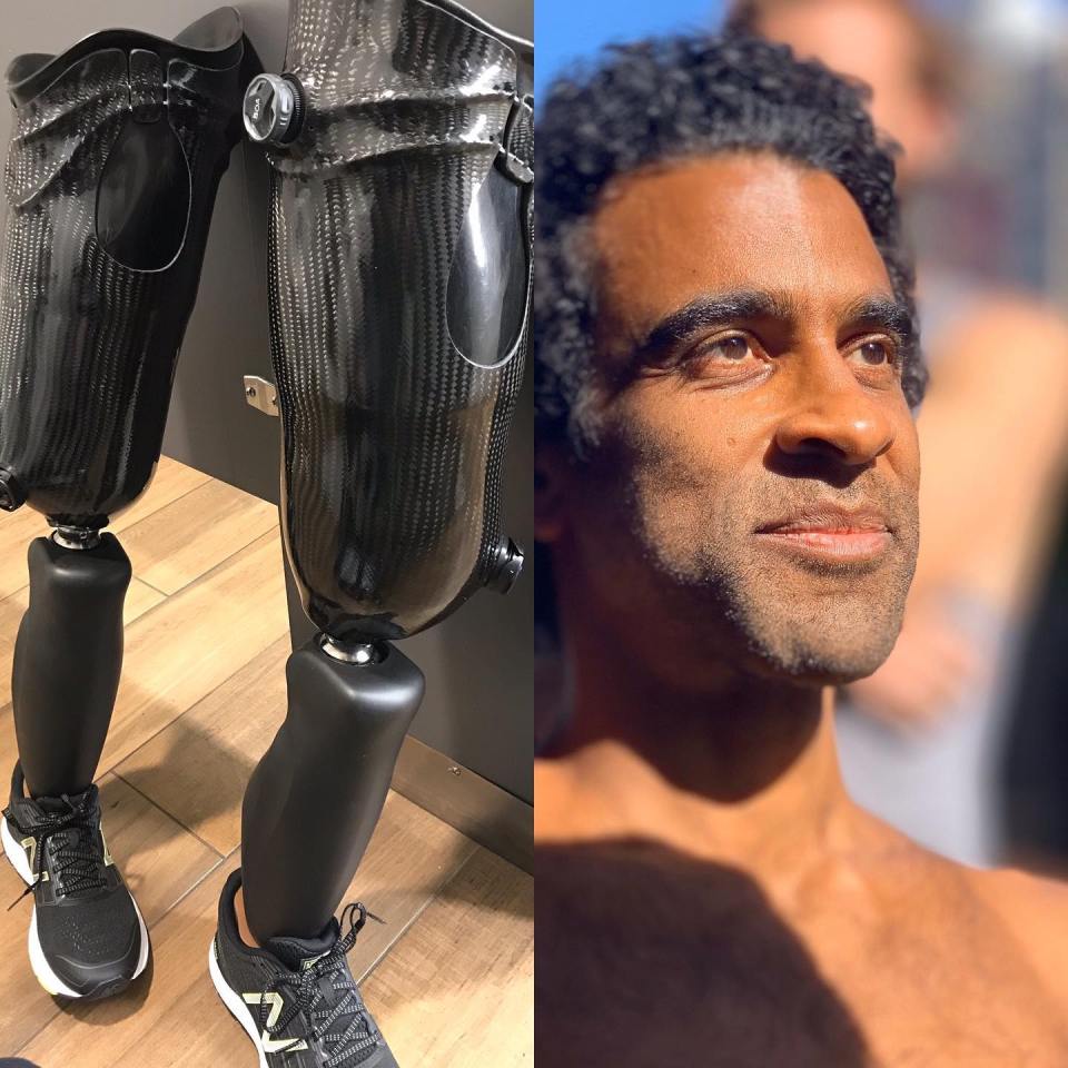 A photo of Obi Ndefo's prosthetic legs and a photo of the actor