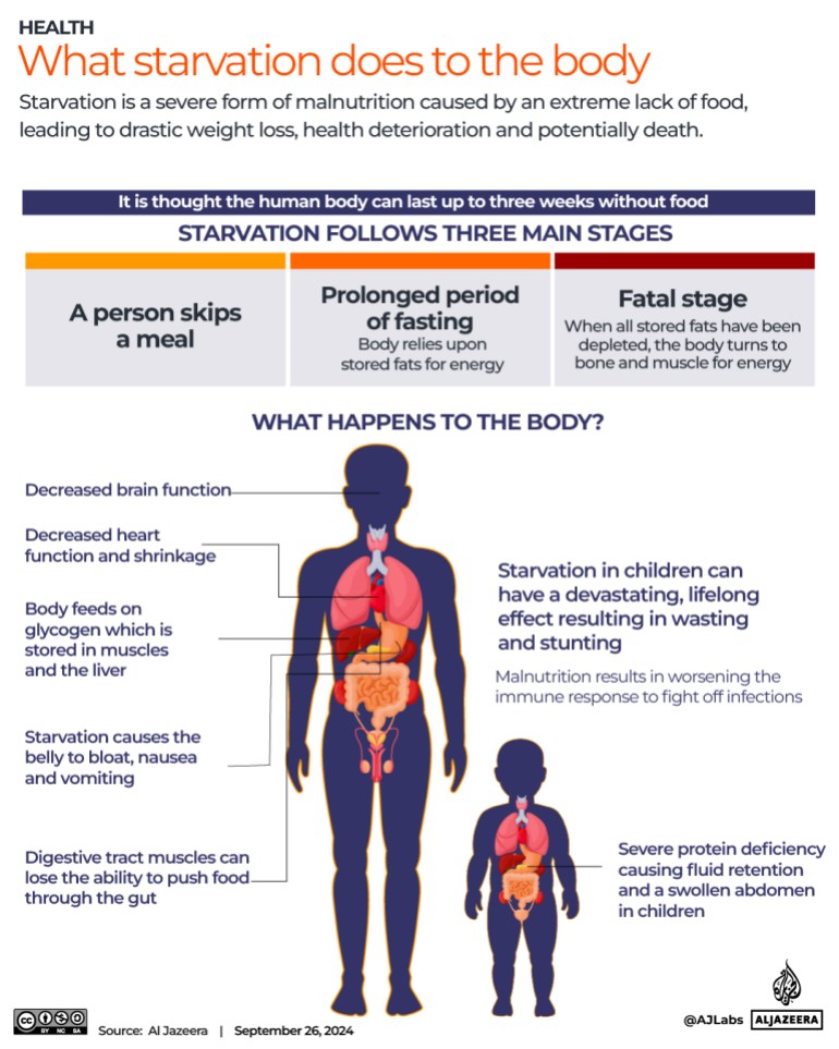 Interactive_Gaza_What starvation does to the body