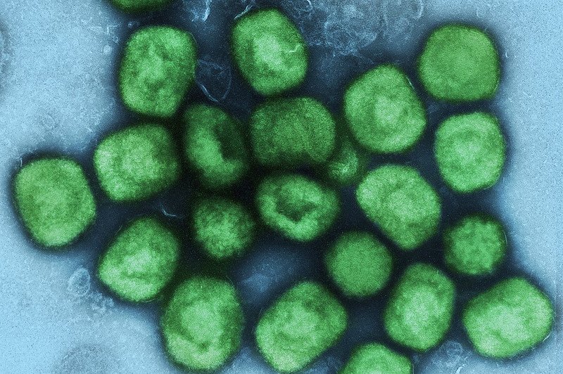 This colorized image from the U.S. National Institute of Allergy and Infectious Diseases' Integrated Research Facility in Fort Detrick, Md., shows an electron micrograph of mpox virus particles (green) cultivated and purified from cell culture. The first known U.S. case of mpox clade I was reported Saturday in California. File Photo courtesy National Institute of Allergy and Infectious Diseases/Flickr