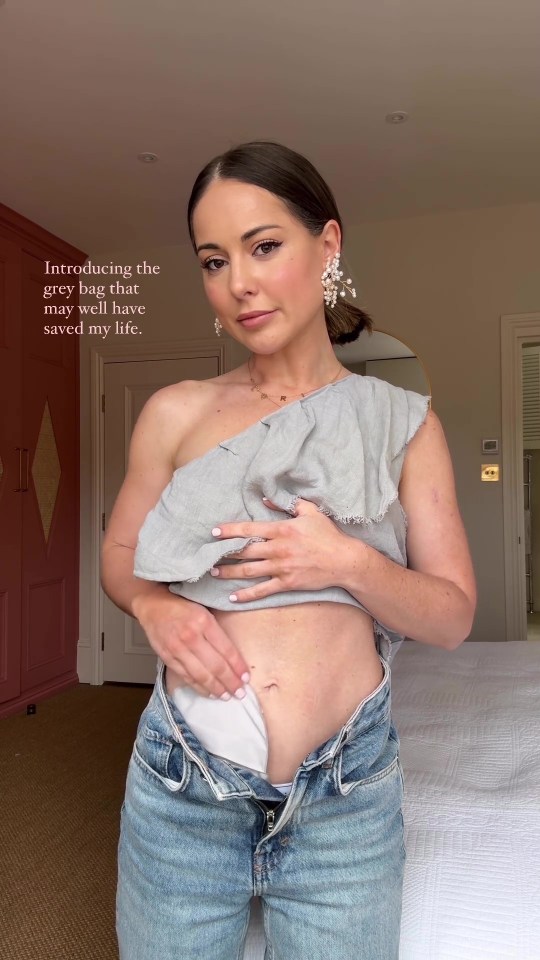 Louise Thompson has had a stoma bag since surgery earlier this year