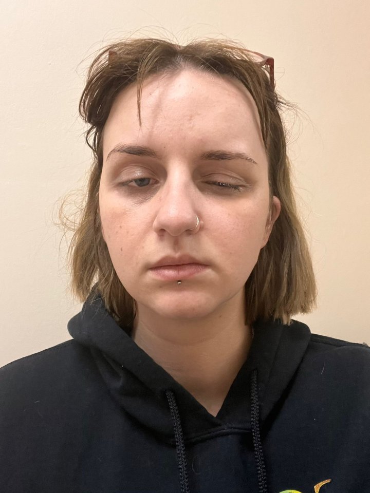 The 26-year-old was struck with a weakened left side and vision loss in her left eye in October 2024