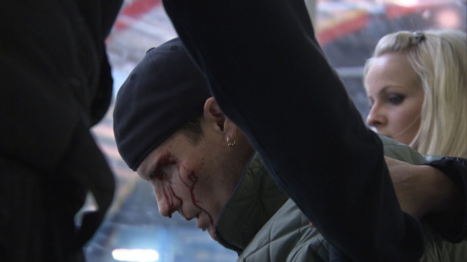 Ice skater with a bloody face being assisted.