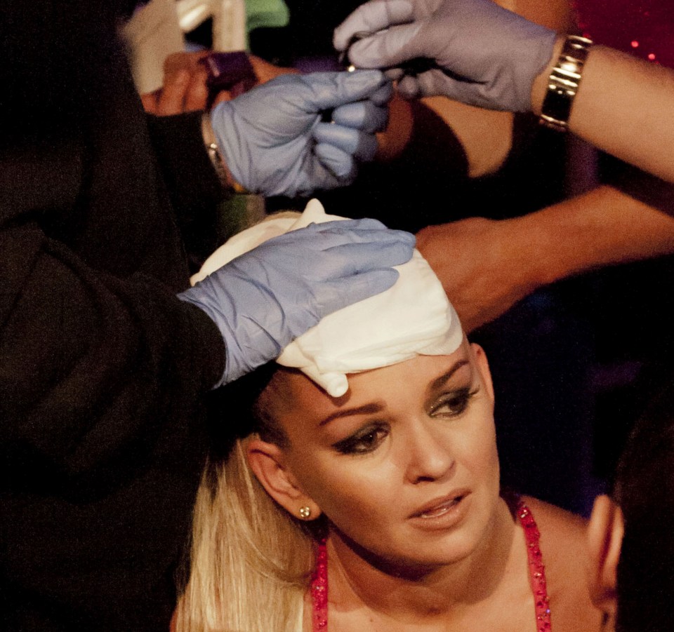 A woman's head is being treated by medical personnel after a figure skating accident.