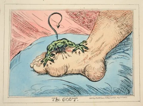 Illustration of gout: a devilish creature biting a foot.