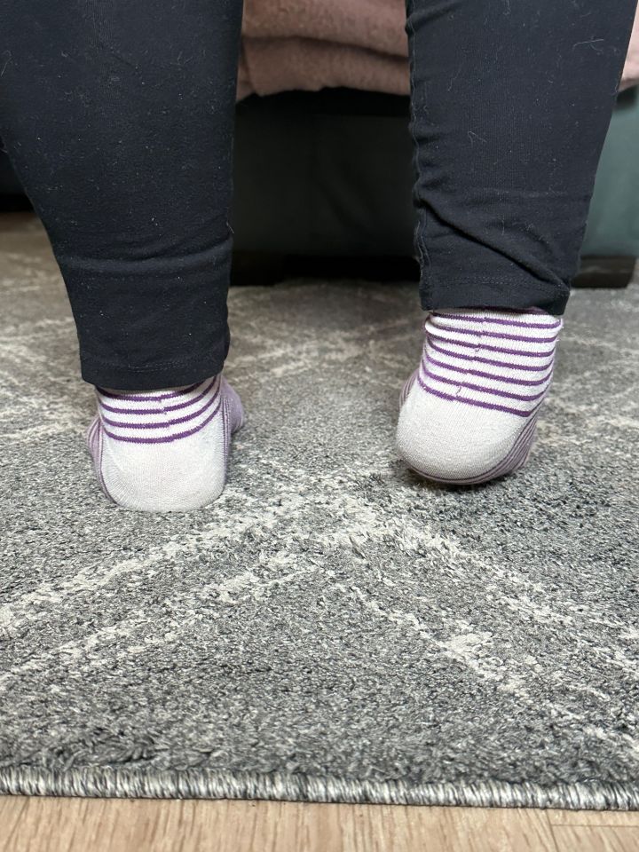 Woman's feet in striped socks, showing a foot turned outwards.