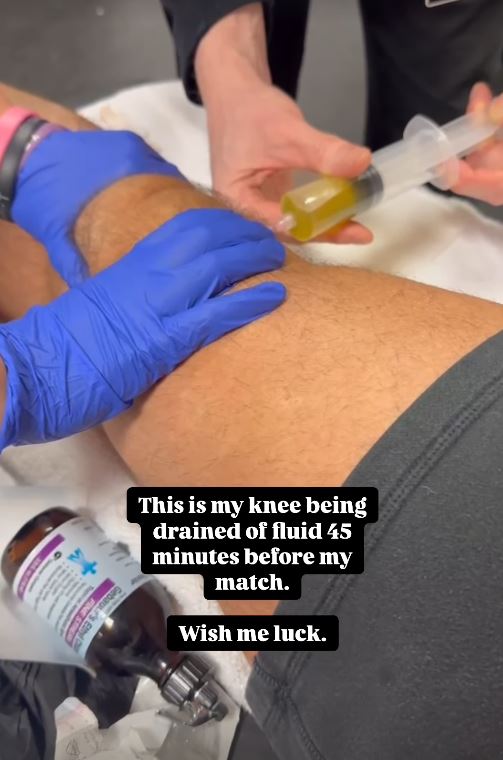 Knee being drained of fluid before a match.