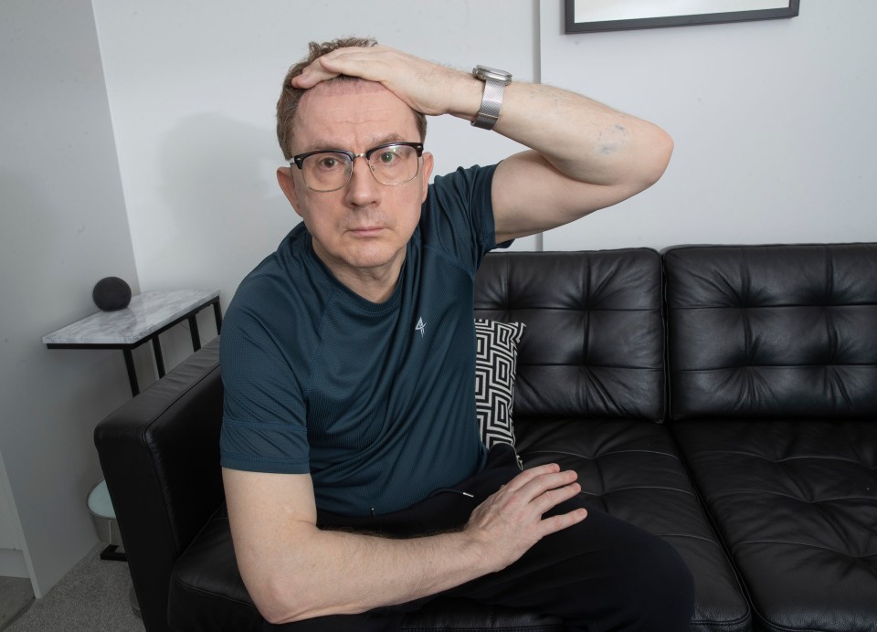 A balding man sits on a couch, touching his forehead.