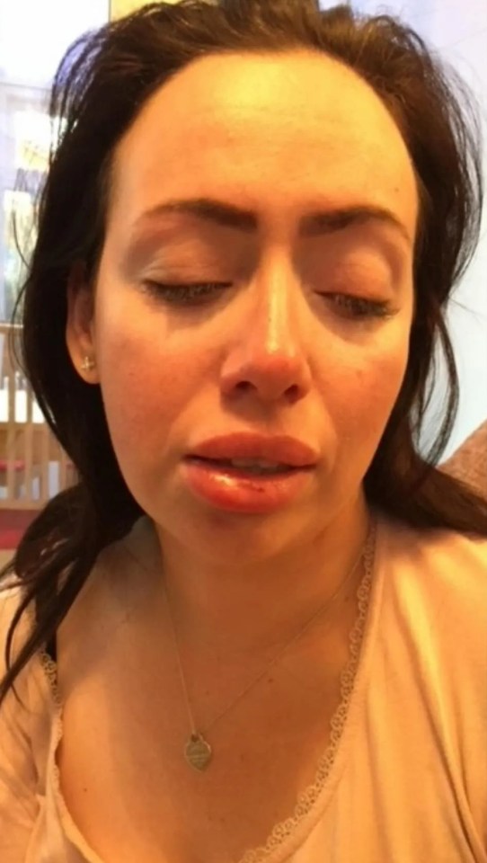 Close-up photo of a crying woman with a cut lip.