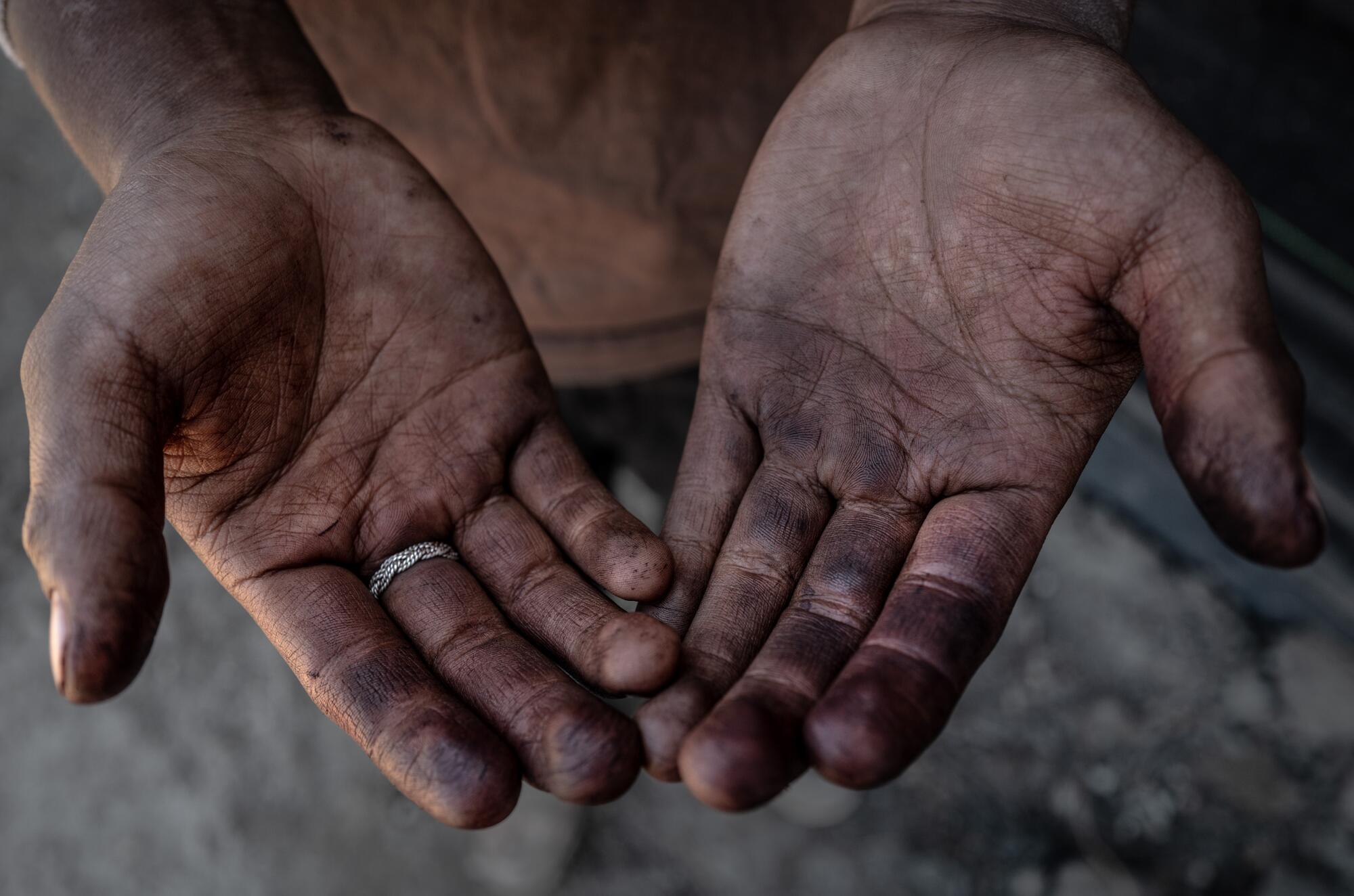 The hands of a 17-year-old strawberry picker