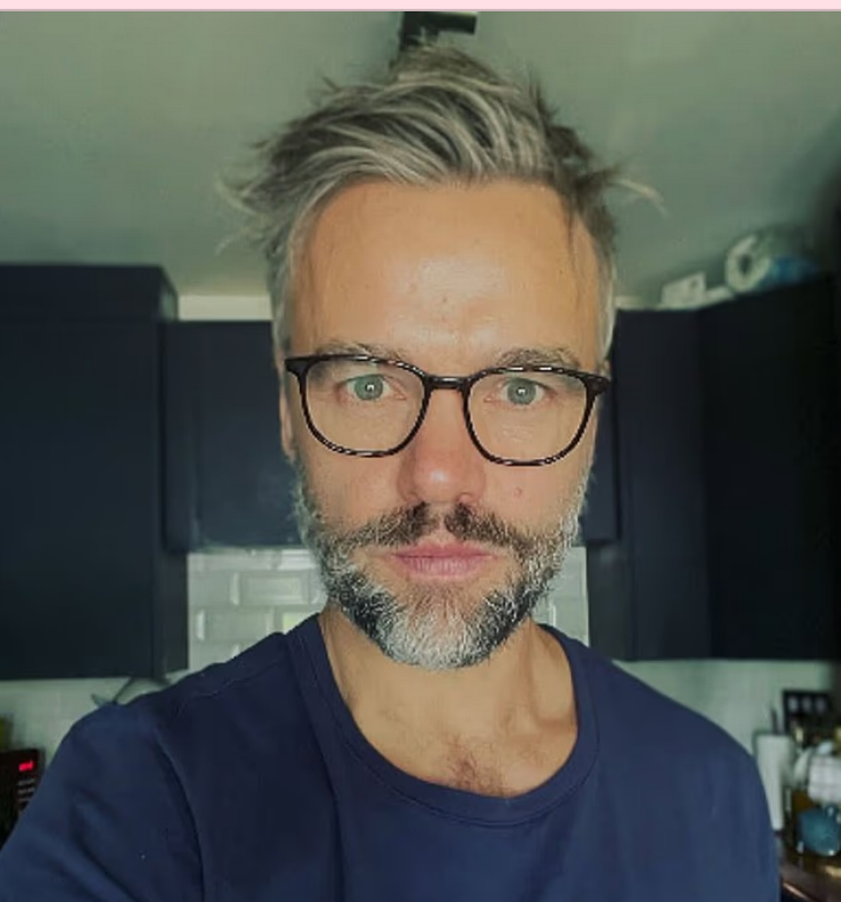 Rupert looked unrecognisable as he announced his return to acting